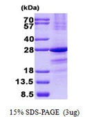 Human SSX1 protein, His tag. GTX67854-pro