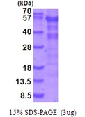 Human LKB1 protein, His tag. GTX67860-pro