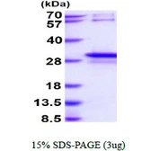 Human STYX protein, His tag. GTX67862-pro