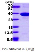 Human SULT1C2 protein, His tag. GTX67863-pro