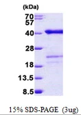Human SURF2 protein, His tag. GTX67866-pro