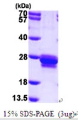 Human Transgelin protein, His tag. GTX67867-pro