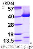 Human Transaldolase protein, His tag. GTX67868-pro