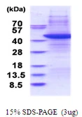 Human TRBP2 protein. GTX67869-pro
