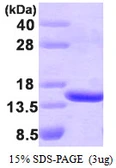 Human TBCA protein. GTX67871-pro