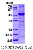 Human TBCC protein, His tag. GTX67872-pro