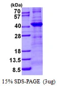 Human TBCC protein, His tag. GTX67872-pro