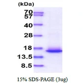 Human Elongin B protein. GTX67876-pro