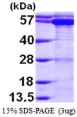 Human TCP1 alpha protein, His tag. GTX67878-pro