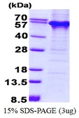 Human TDG protein, His tag. GTX67882-pro