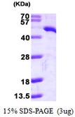 Human TDO2 protein, His tag. GTX67883-pro