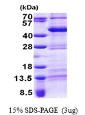 Human TEF protein, His tag. GTX67884-pro