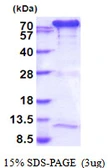 Human Transglutaminase 2 protein, His tag. GTX67885-pro