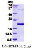 Human THRSP protein, His tag. GTX67886-pro