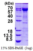 Human Transketolase protein, His tag. GTX67889-pro
