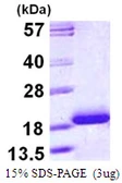 Human Cardiac Troponin C protein, His tag. GTX67891-pro