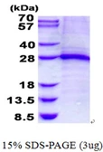 Human TNNI1 protein, His tag. GTX67892-pro