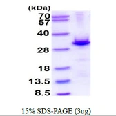 Human Cardiac Troponin I protein, His tag. GTX67894-pro