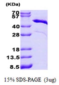 Human Cardiac Troponin T protein, His tag. GTX67895-pro