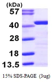 Human Tropomyosin 2 protein, His tag. GTX67898-pro