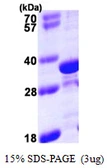 Human Tropomyosin 4 protein, His tag. GTX67900-pro