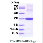Human Translin protein. GTX67903-pro