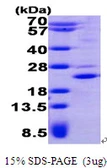 Human TSSC3 protein, His tag. GTX67905-pro