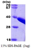 Human TST protein, His tag. GTX67906-pro