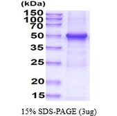 Human TUBG1 protein, His tag. GTX67909-pro