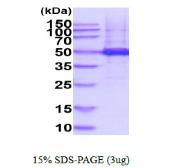 Human TUBG1 protein, His tag. GTX67910-pro