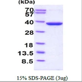Human Thymidylate synthase protein, His tag. GTX67911-pro