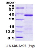 Human U2AF35 protein, His tag. GTX67912-pro