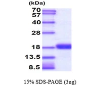 Human UBE2D1 protein, His tag. GTX67915-pro