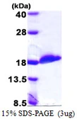 Human UBE2D2 protein, His tag. GTX67916-pro