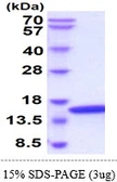 Human UBE2D2 protein. GTX67917-pro