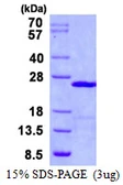 Human UBE2E1 protein, His tag. GTX67919-pro