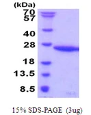 Human UBE2G1 protein, His tag. GTX67920-pro