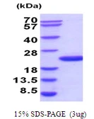 Human UBE2G2 protein, His tag. GTX67921-pro