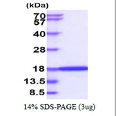 Human UBE2I protein. GTX67923-pro