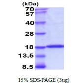 Human UBE2L3 protein. GTX67924-pro