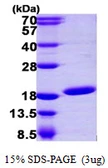 Human UBE2N protein, His tag. GTX67925-pro