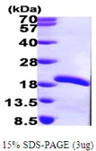 Human MMS2 protein, His tag. GTX67926-pro