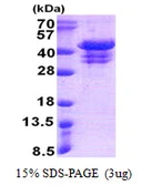 Human UFD1L protein, His tag. GTX67927-pro