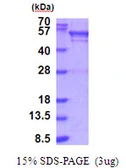 Human UGP2 protein, His tag. GTX67928-pro