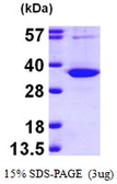 Human UPP1 protein, His tag. GTX67932-pro
