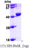 Human UROD protein, His tag. GTX67933-pro