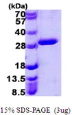 Human UROS protein, His tag. GTX67934-pro