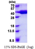 Human PFDN3 protein, His tag. GTX67936-pro