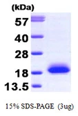 Human Visinin-like 1 protein. GTX67938-pro