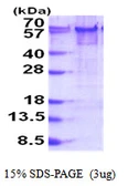 Human YY1 protein, His tag. GTX67943-pro